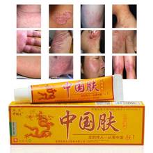 15g Psoriasis Cream Skin Care Dermatitis Eczema Treatment Anti-itch Chinese Herbal Medical Plaster Antibacterial Ointment 2024 - купить недорого