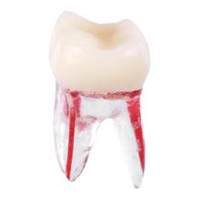 1:1 полимерная Стоматологическая модель Эндодонтических зубов с цветным корневым каналом и целлюлозой, стоматологические инструменты для студентов, обучения, 1 шт. 2024 - купить недорого