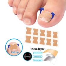 30/50/100 Toe Nail Repair Foot Corrector Stickers Paronychia Treatment Ingrown Nail Patch Correction Stickers Pedicure Tool 2024 - buy cheap