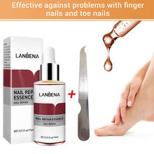 Tratamiento líquido de reparación de uñas con Lima, iluminador de uñas, antihongos, cuidado de uñas, TSLM1 2024 - compra barato