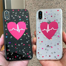 Capa de celular macia com glitter., para samsung galaxy a50, a70, a40, s8, s10e, s9 plus, s20, ultra, a10, a30, a20, a80, a90, a60, note 9, 10e 8, s7 edge. 2024 - compre barato