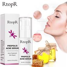 RtopR Propolis Acne Treatment Serum Repair Acne Brightening Shrink Pore Eliminates Acne Scar Spot Essence Oil control Serum 20ml 2024 - buy cheap