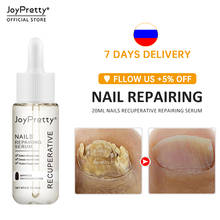 Сыворотка JoyPretty для лечения грибка ногтей, средство против грибков, уход за ногами, против грибков, лак для ногтей, масло против грибков, удаляет гель, 20 мл