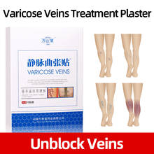 12 Patches Spider Legs Veins Varicose Treatment Paste Varicosity Repair Phlebitis Legs Pain Relief Health Care 2024 - buy cheap