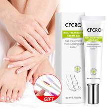 Creme de remoção de fungos de unhas peças, tratamento de onicomicose, paroníquia, produto anti-infecção de unhas, gel para cuidados com as unhas dos pés e dos pés 2024 - compre barato