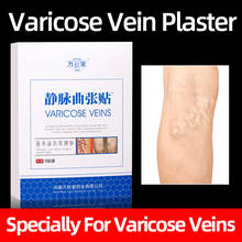 6/12PC Varicose Veins Natural Herbal Medicine Treatment Care Stickers Relieve Angitis Vein Pain Phlebitis Health Care Patch 2024 - buy cheap