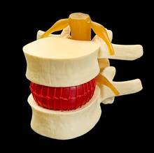 Modelo de esqueleto de coluna lombar, modelo de ensino para coluna vertebral humana, modelo de demonstração de patologia 2024 - compre barato