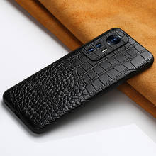 Genuine Leather Case for Xiaomi Redmi Note 10 Pro 10S Note 9 Pro 8 9T Cover For Mi 10 11 Ultra 10T Lite Poco X3 Pro NFC F3 GT M3 2024 - купить недорого