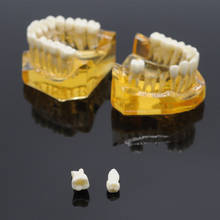 1pc Denal Lab Removable Teeth Adult Typodont Model For Teaching 2024 - buy cheap