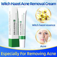 Creme relaxante para encolher poros, tratamento para acne e cicatriz, remoção de cravos 2024 - compre barato