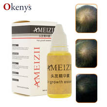 Эссенция роста волос AIMEIZI жидкость для выпадения волос 20 мл лечение восстановления волос густые волосы быстрое восстановление имбиря 2024 - купить недорого