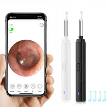Otoscópio de orelha com luzes led, endoscópio de 5.5mm com capa para orelha, cuidado com a saúde de android e ios, limpeza de cera 2024 - compre barato