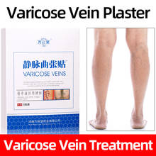 12pieces Varicose Veins Cure Patch Spider Legs Varicosity  Treatment Plaster Natural Herbal Medically Skin Care 2024 - buy cheap