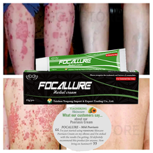 10pcs NO BOX YIGANERJING FOCALLURE Body Psoriasis Cream Dermatitis Eczematoid Eczema Ointment Treatment Psoriasis Balm 15g 2024 - buy cheap