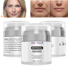 MO TULIP Organic Retinol Cream Moisturizer Cream Vitamin C Whitening Anti Aging Wrinkles High Quality Face Cream DROP SHIPPING 2024 - buy cheap