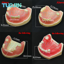 Free Shipping Dental Implant Teeth Model Teaching Model Soft Gum Dental Teeth Education Model For Student Practice Set Training 2024 - buy cheap