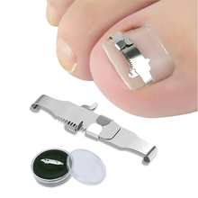 Ingrown toenail corrector Tools Pedicure Recover Embed Toe Nail Treatment professional Ingrown toenail correction Foot Care Tool 2024 - купить недорого