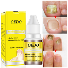 Эссенция OEDO для удаления грибка на ногтях, Отбеливающее масло для ногтей, увлажняющее средство для ухода за ногами, 10 мл, TSLM2 2024 - купить недорого